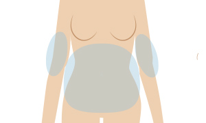 医療痩身・メディカルダイエット 全身