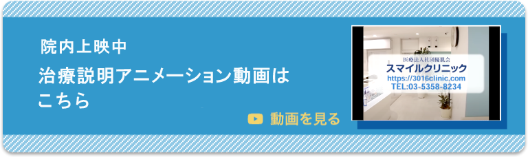 Youtubeでスマイルクリニックの施術をご紹介
