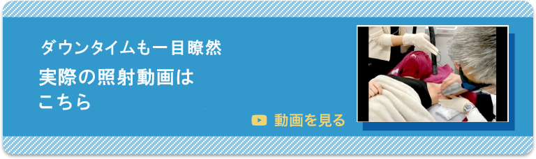 Youtubeでスマイルクリニックの施術をご紹介